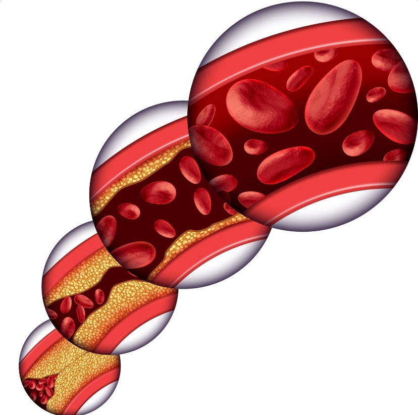 cholesterol