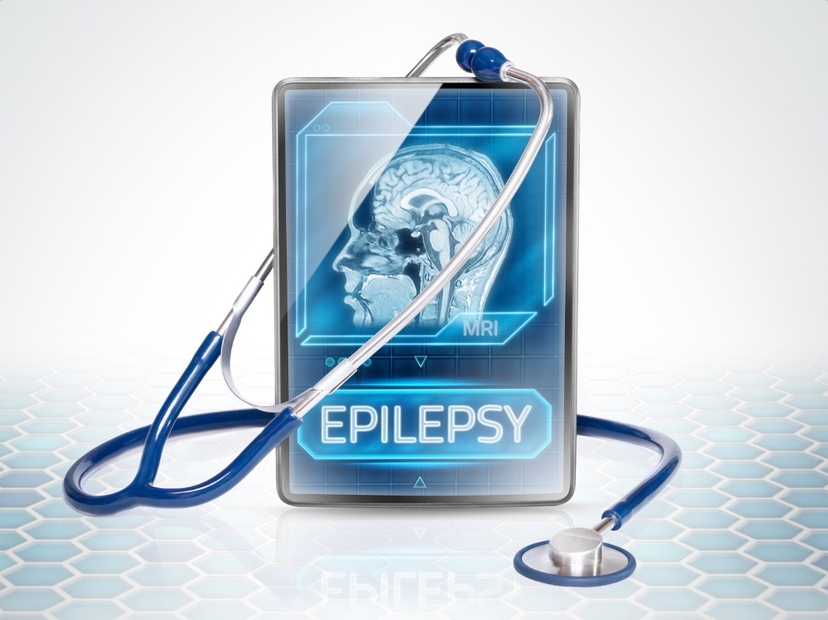 Epilepsy