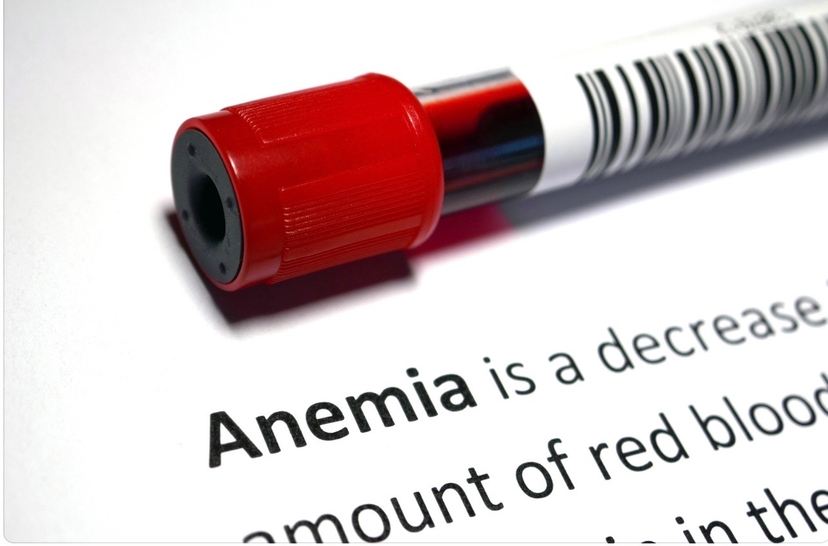 Anaemia