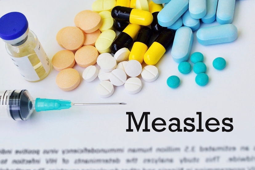 Measles