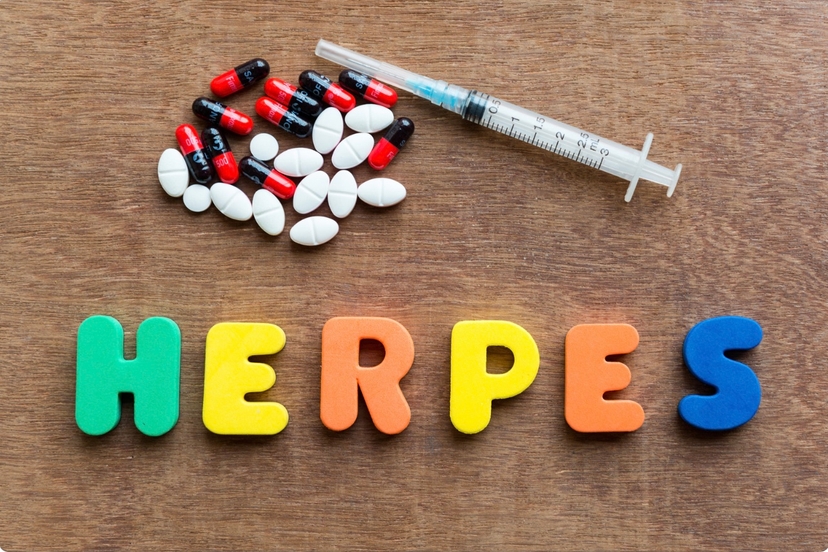 Herpes