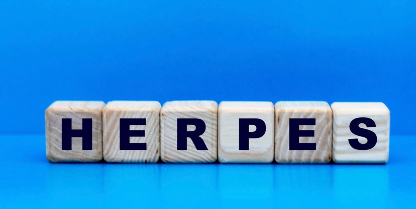 Herpes