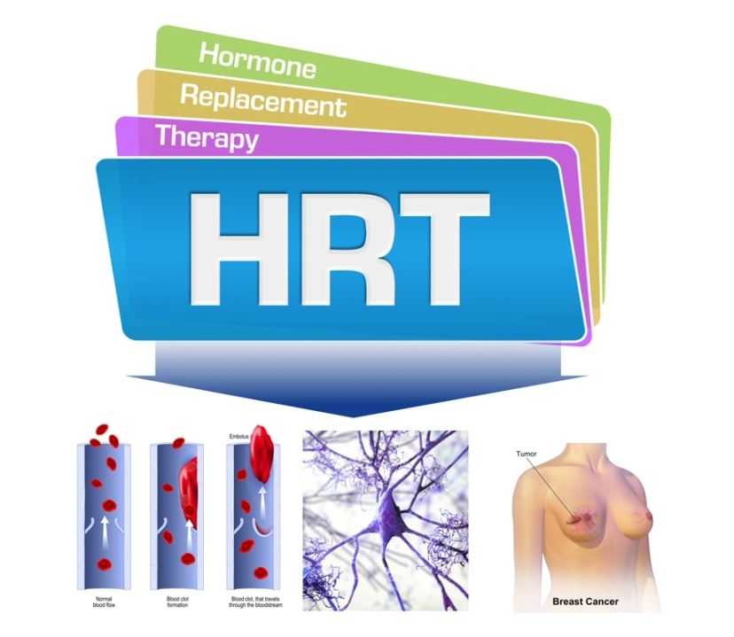 Safe HRT treatment for breast cancer.