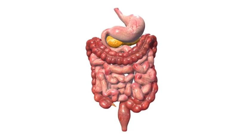 A 3D image of a human intestine showing signs of cancer.