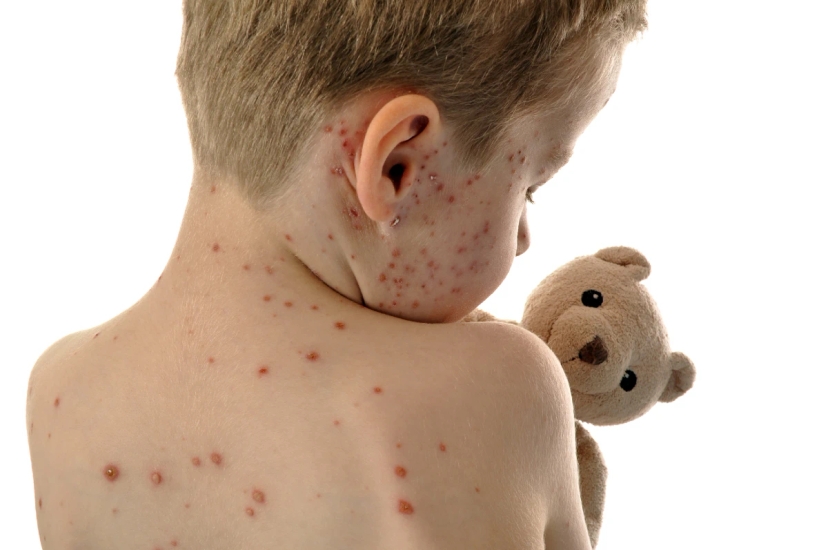 A boy holding a teddy bear with spots on his back looks twice as cute.