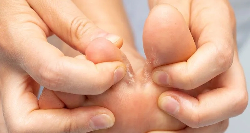 A person's foot is being massaged by a person, providing relief from symptoms of athletes foot.