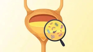 Illustration of a bladder with a magnifying glass highlighting various bacteria inside, emphasizing the importance of UTI testing for diagnosing urinary tract infections.