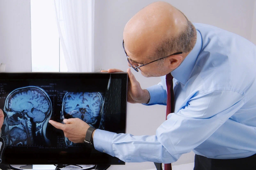 Doctor examining and pointing at brain scans on a screen, discussing prognosis and life expectancy for motor neurone disease.