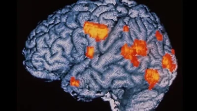 An MRI scan of a brain with highlighted areas in orange, indicating active regions typically associated with brain function and neural activity