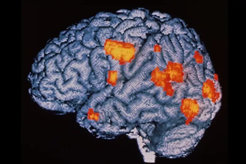 An MRI scan of a brain with highlighted areas in orange, indicating active regions typically associated with brain function and neural activity