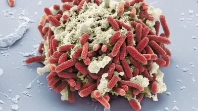 Microscopic view of a cluster of bacteria with red rod-shaped cells on a grey surface, potentially indicating E. coli infection.