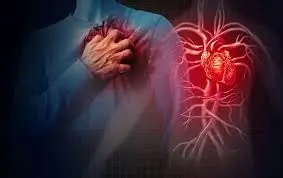 Illustration showing a person clutching their chest in pain, with an anatomical representation of a heart and blood vessels highlighted, depicting symptoms of unstable angina.