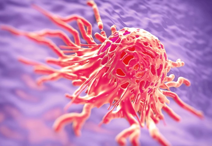 Microscopic image of a cancer cell, representing highlighting the potential treatment for cervical cancer