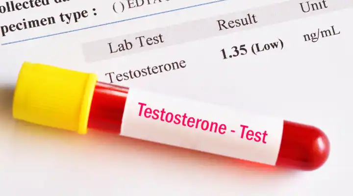 Blood test to check testosterone levels and recommending testosterone replacement therapy