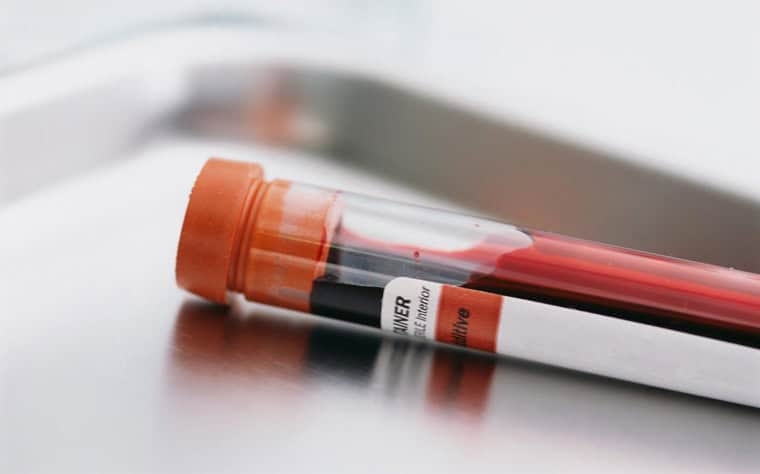 blood sample in a tube to check if any signs of cancer are related to TRT