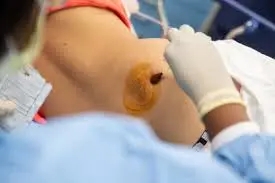 a patient laying down due to the doctor carrying out a bone marrow test procedure