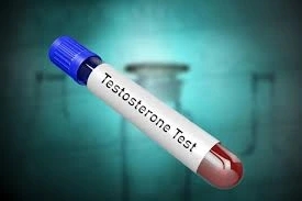 Blood test to confirm testosterone levels before testosterone replacement therapy starts