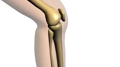 An image of knee joint