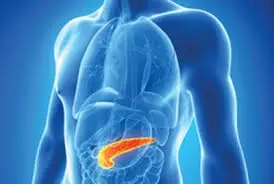 What is chronic pancreatitis? taking a look at a body image showing orange pancreatitis