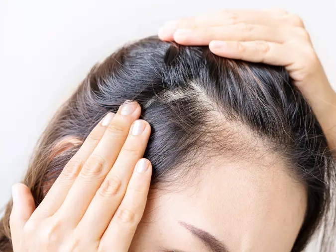 Taking a look if low iron levels cause hair loss