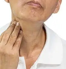 signs of lymphoma on the neck