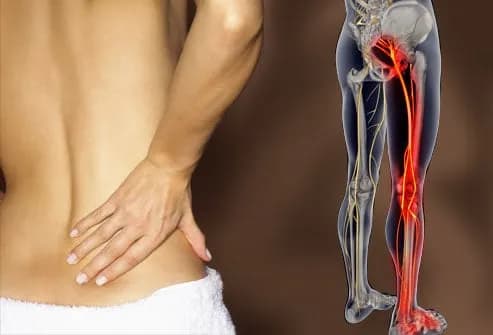 A person holding their lower back in pain, with a medical illustration showing highlighted sciatic pain running from the lower spine down the leg, seeking sciatica pain relief.