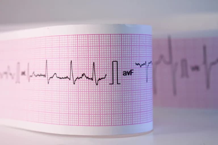 What is Atrial fibrillation?