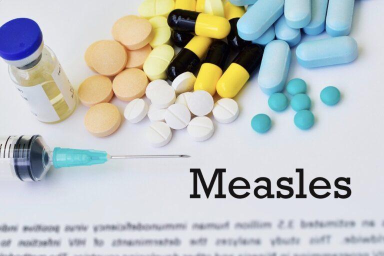 Measles