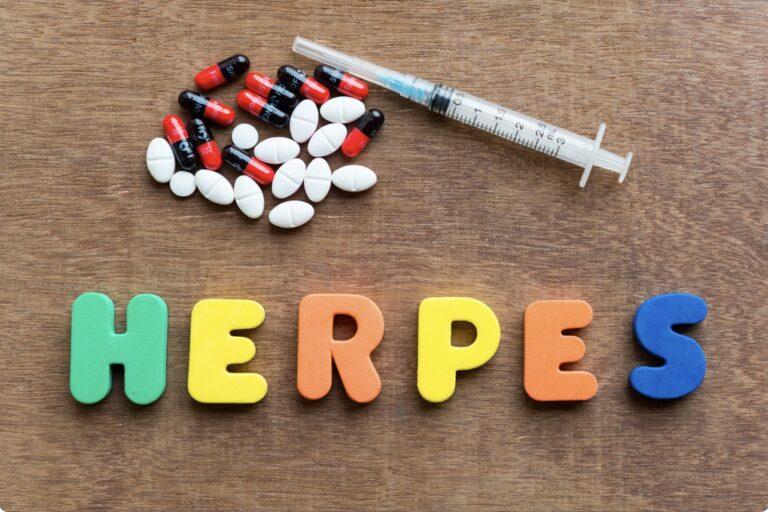 Herpes