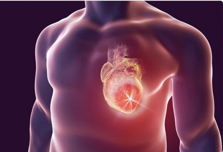 Angina