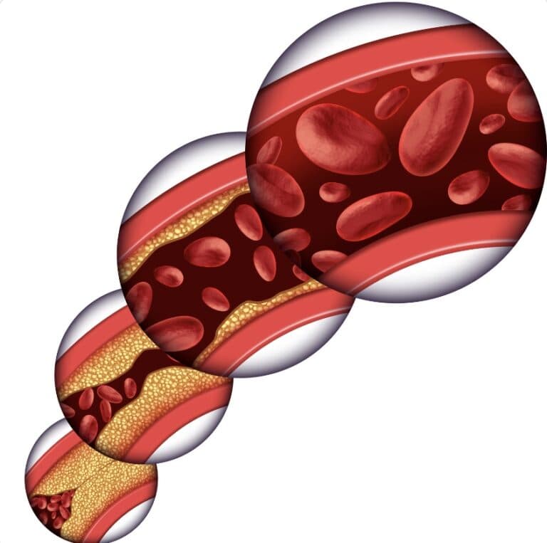 cholesterol