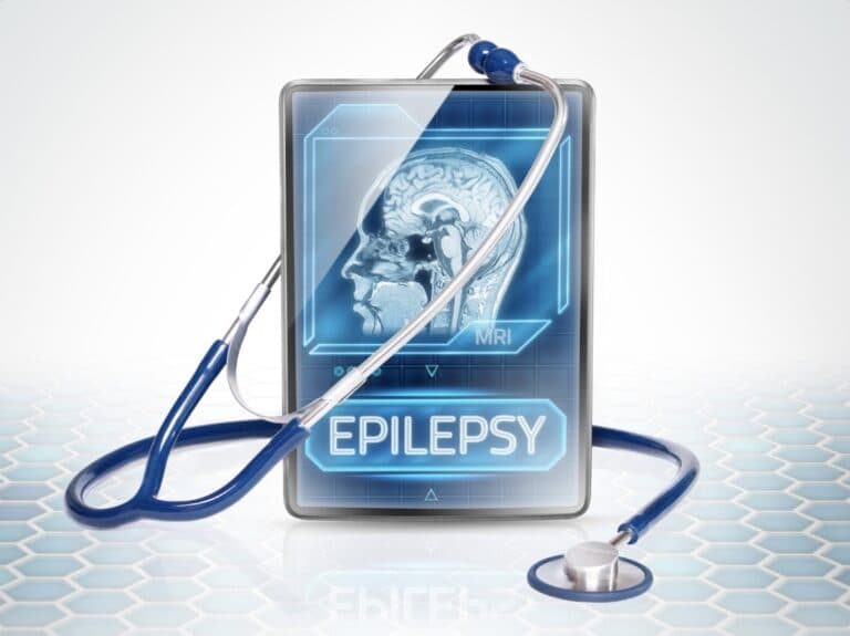 Epilepsy
