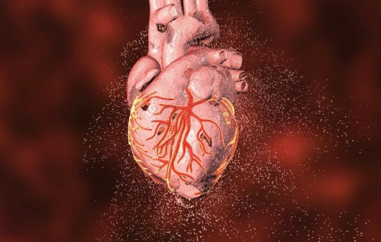 Heart Disease