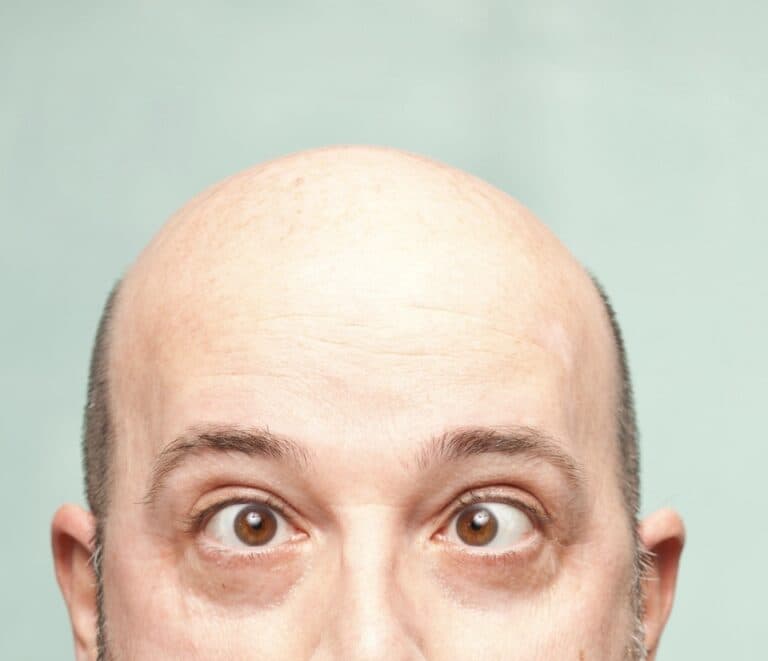 Bald man