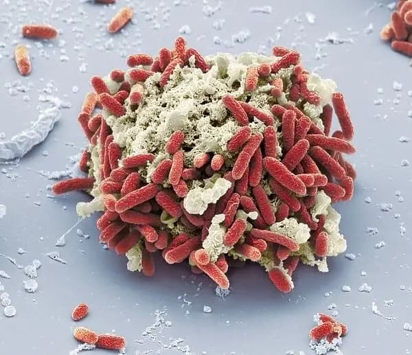 Microscopic view of a cluster of bacteria with red rod-shaped cells on a grey surface, potentially indicating E. coli infection.