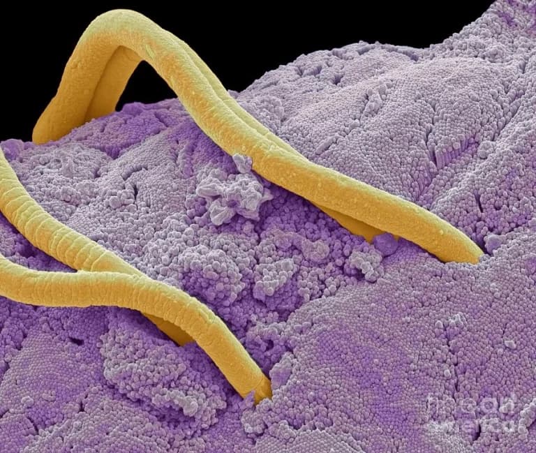 How to remove threadworms