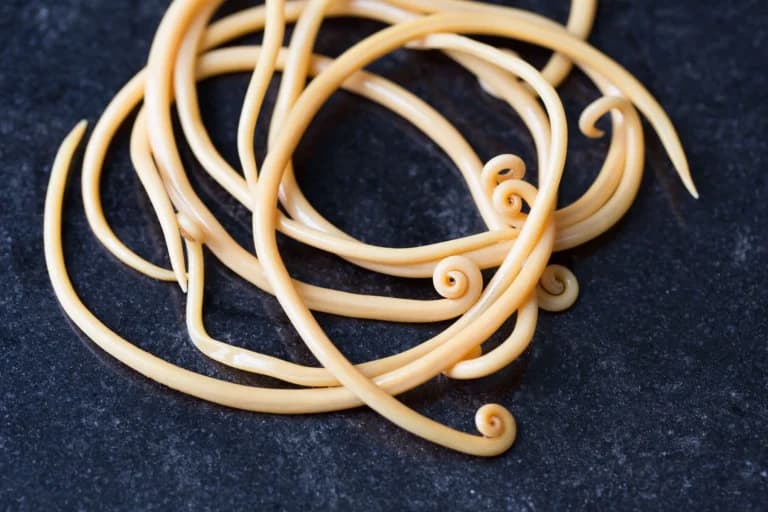 image showing what are threadworms