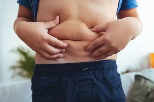 What is class 1 obesity?