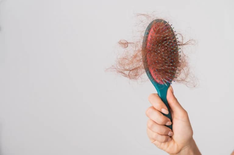 Weight Loss and Hair Loss