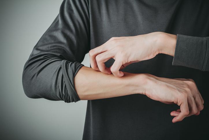 man scratching arm