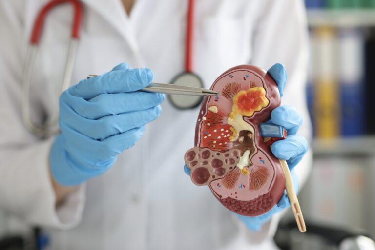 Kidney Disease