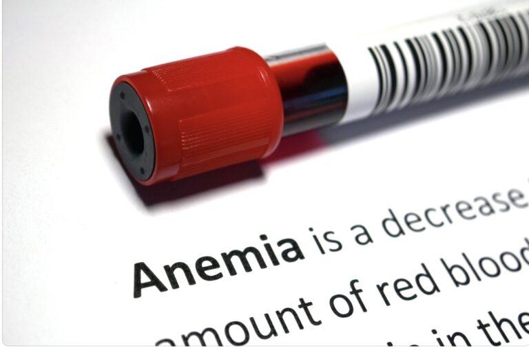 Anaemia