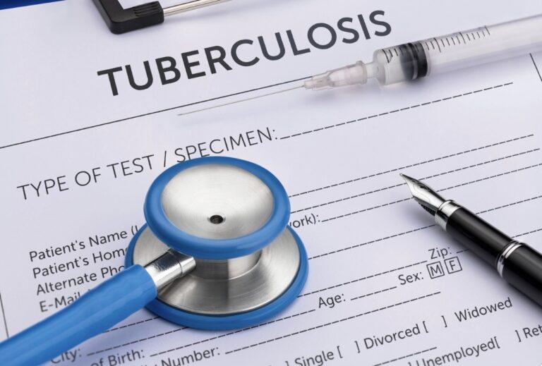 TB Tuberculosis