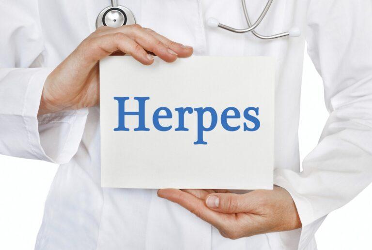 Herpes