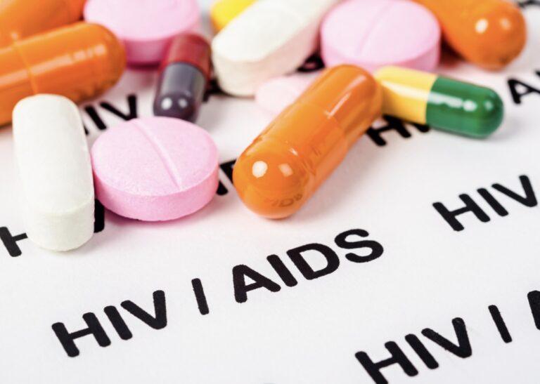 HIV aids