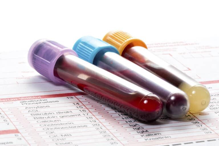 Three blood test tubes sitting atop a medical chart during an NHS health check.