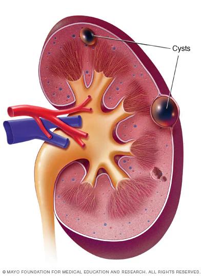 A diagram of a kidney with a blood vessel in the renal system.