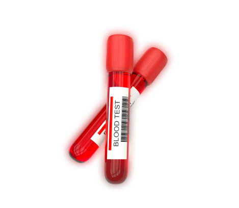 Two blood test vials with red caps on a red, heart-shaped backdrop, demonstrating key features.