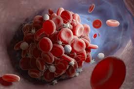Blood clot forming