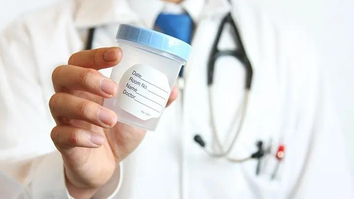 A doctor holding a labeled urine sample container, showcasing the accuracy of UTI testing.